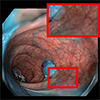 Depth-Aware Endoscopic Video Inpainting