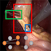 Adaptive Graph Learning from Spatial Information for Surgical Workflow Anticipation